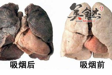 别让香烟燃尽生命 救“肺”正在行动